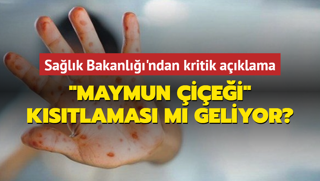 Trkiye'ye 'maymun iei' kstlamas m geliyor" Salk Bakanl'ndan kritik aklama