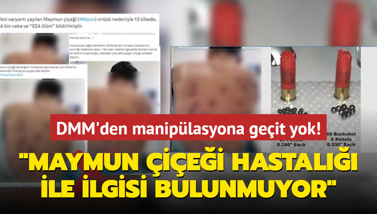 DMM'den maniplatif grntler hakknda aklama: Maymun iei hastal ile hibir ilgisi bulunmuyor