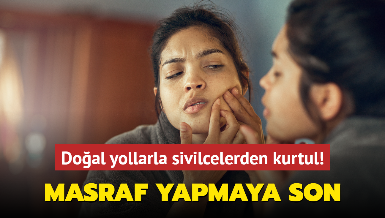 Doal yollarla sivilcelerden kurtul! Masraf yapmaya son