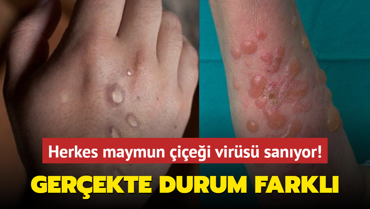 Herkes maymun iei virs sanyor! Gerekte durum farkl