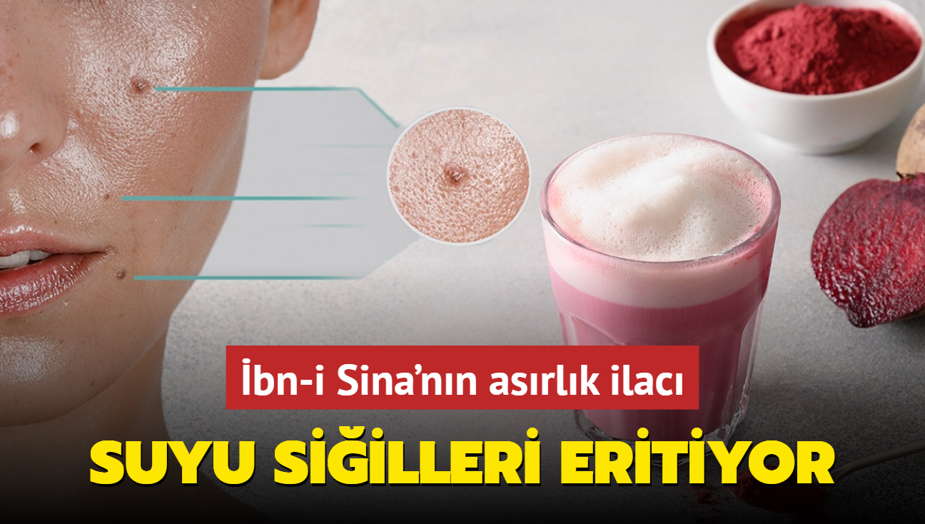 Suyu siilleri, yapra benleri eritiyor! bn-i Sina'nn asrlk ilac