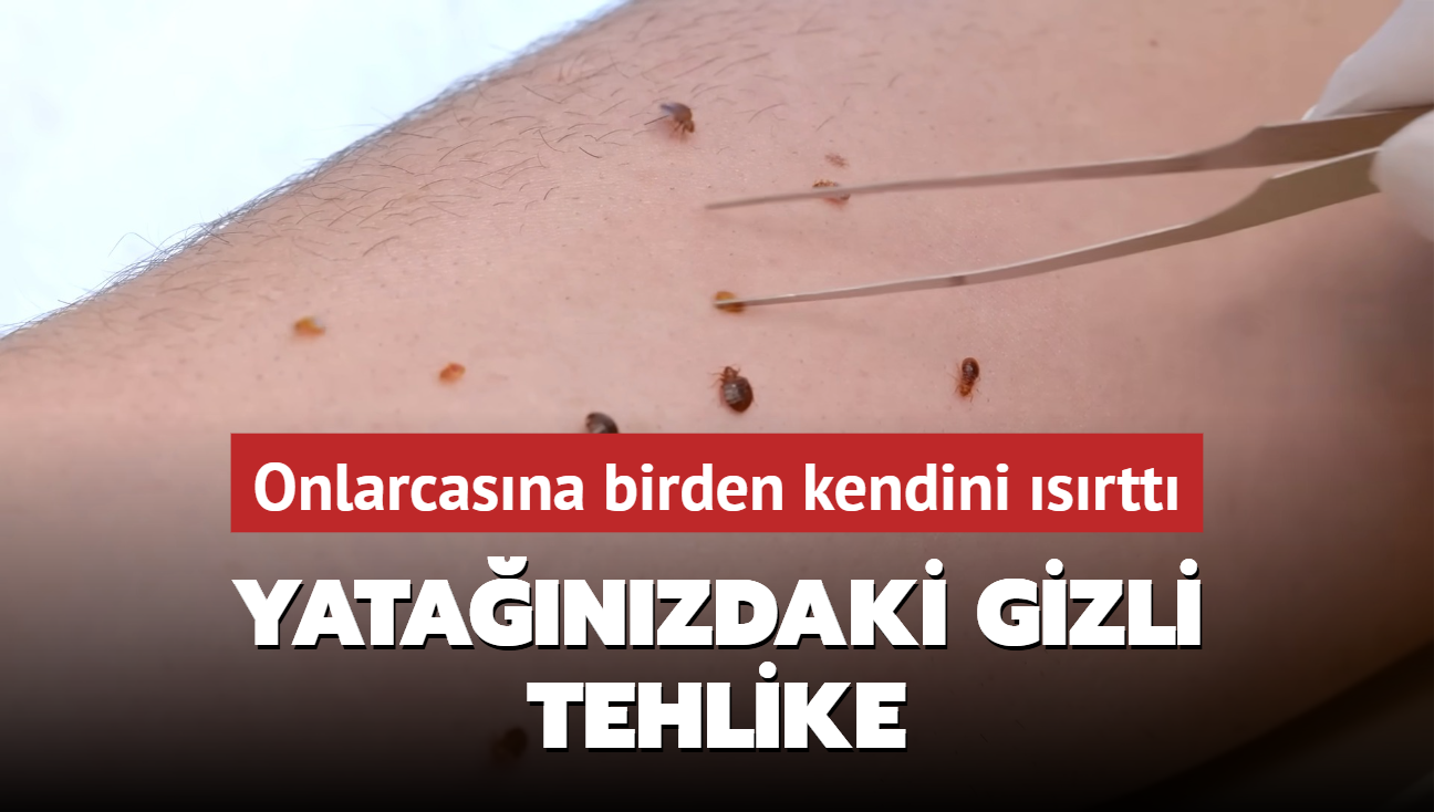 Onlarcas�na birden kendini �s�rtt�! Yata��n�zdaki gizli tehlike