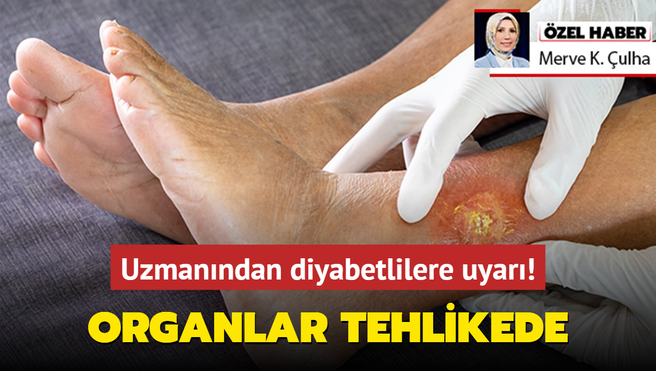 Uzman uyard! Diyabetliler dikkat etmezse organn kaybedebilir