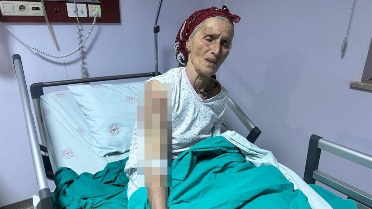 Komusunun kpekleri saldrd... "lecektim"