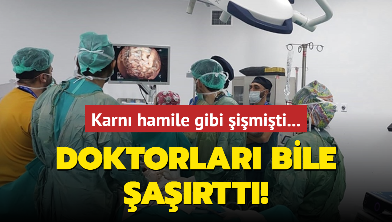 Karn hamile gibi imiti... Doktorlar bile artt!