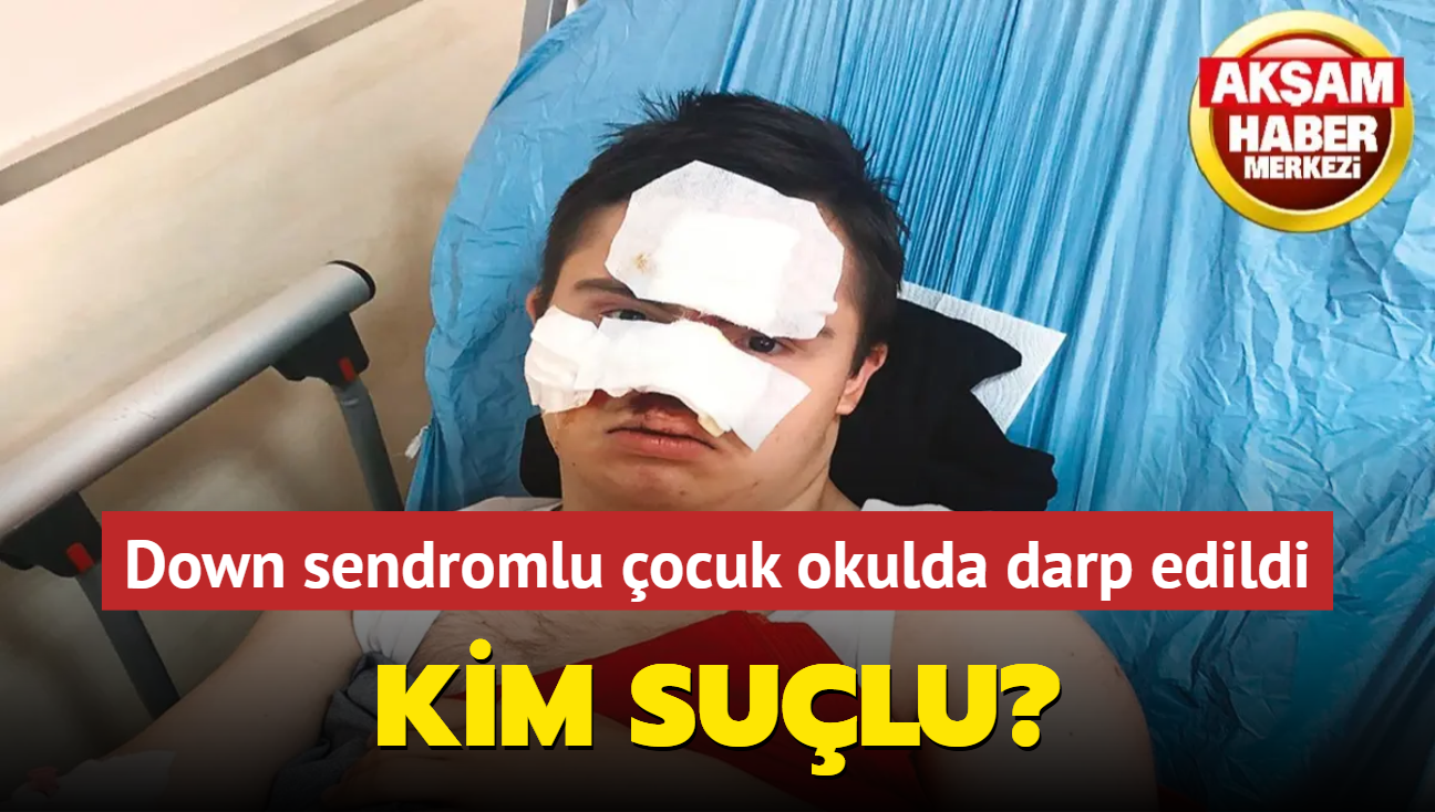 Kim sulu" Down sendromlu ocuk, okulda darp edildi