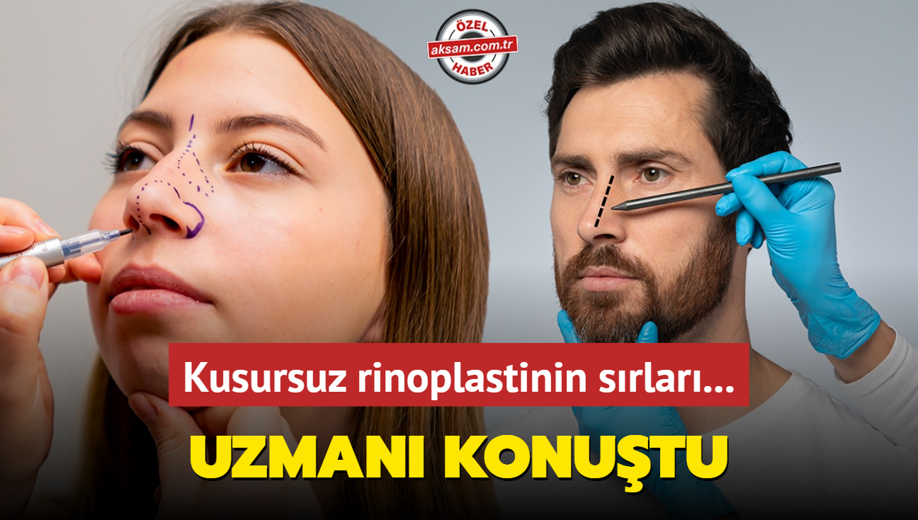 Kusursuz rinoplastinin srlar... Kaburgadan burna takviye kkrdak: Uzman konutu