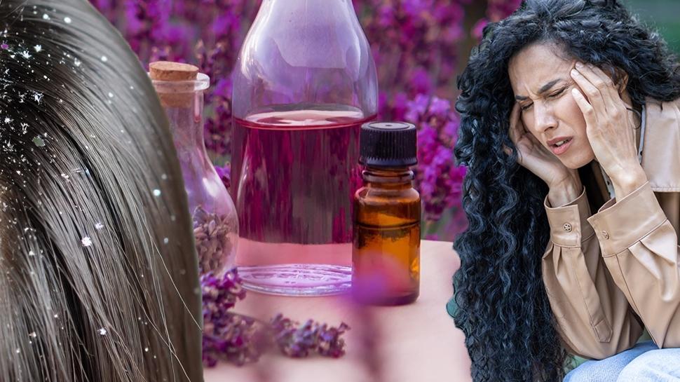 Bilimsel olarak kanıtlandı! Yağı baş ağrısını suyu saçtaki kepeği yok ediyor