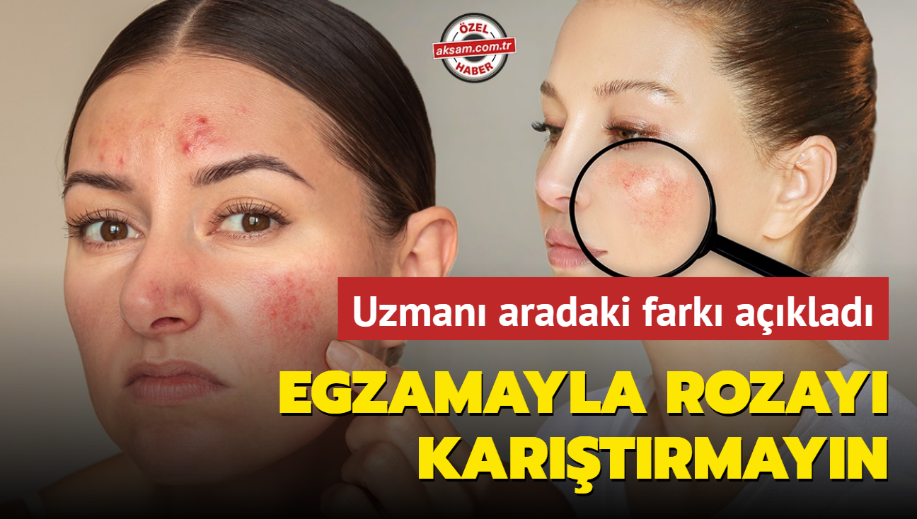 Egzamayla rozay kartrmayn! Uzman aklad, biri gzden dieri damardan belli oluyor