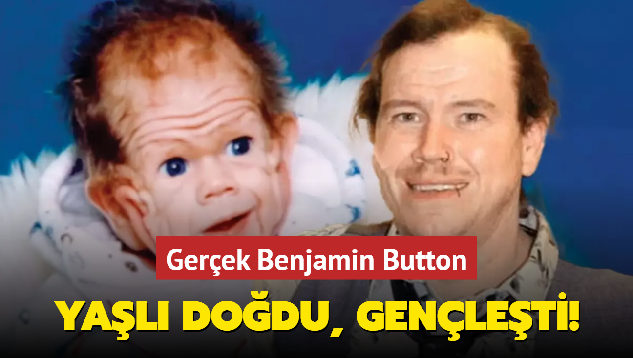 Gerek Benjamin Button... Yal dodu, genleti!