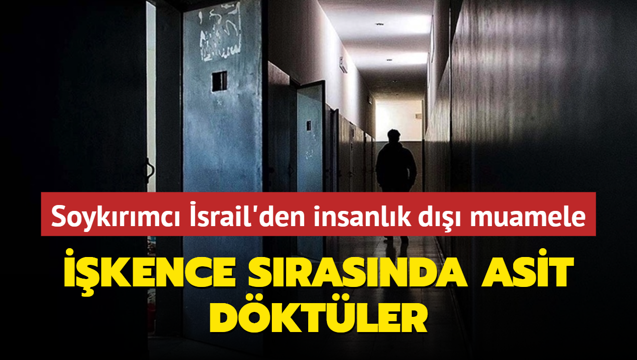 Soykrmc srail'den insanlk d muamele: Filistinli mahkuma ikence srasnda asit dktler