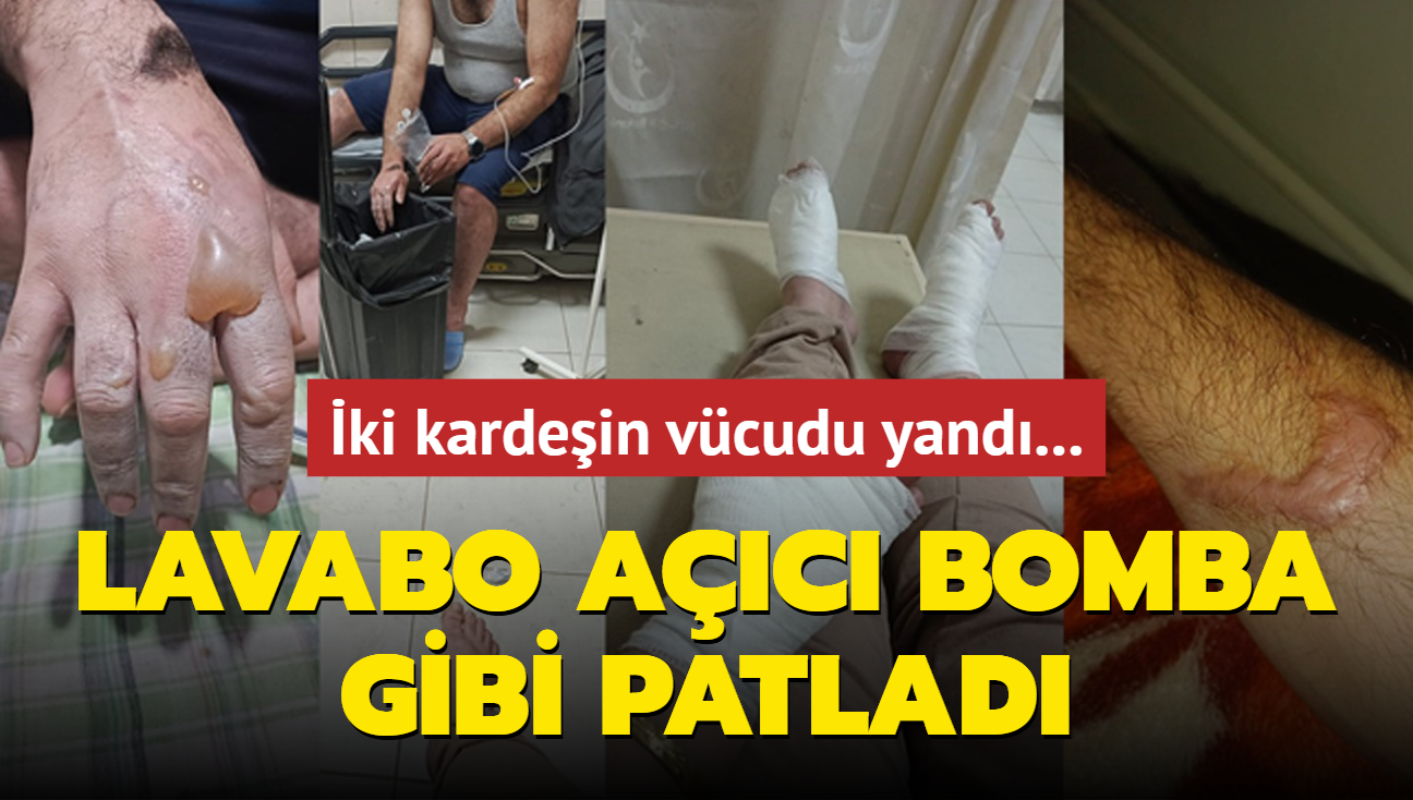 Lavabo ac bomba gibi patlad: ki kardein vcudu yand!