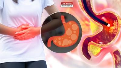 Uzman� uyard�: Refl�de a�l�k sorun de�il! O hata mideyi ya deliyor ya yak�yor