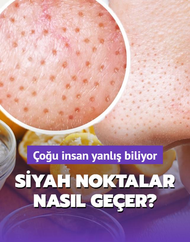 Limon siyah noktalar yok eder mi?