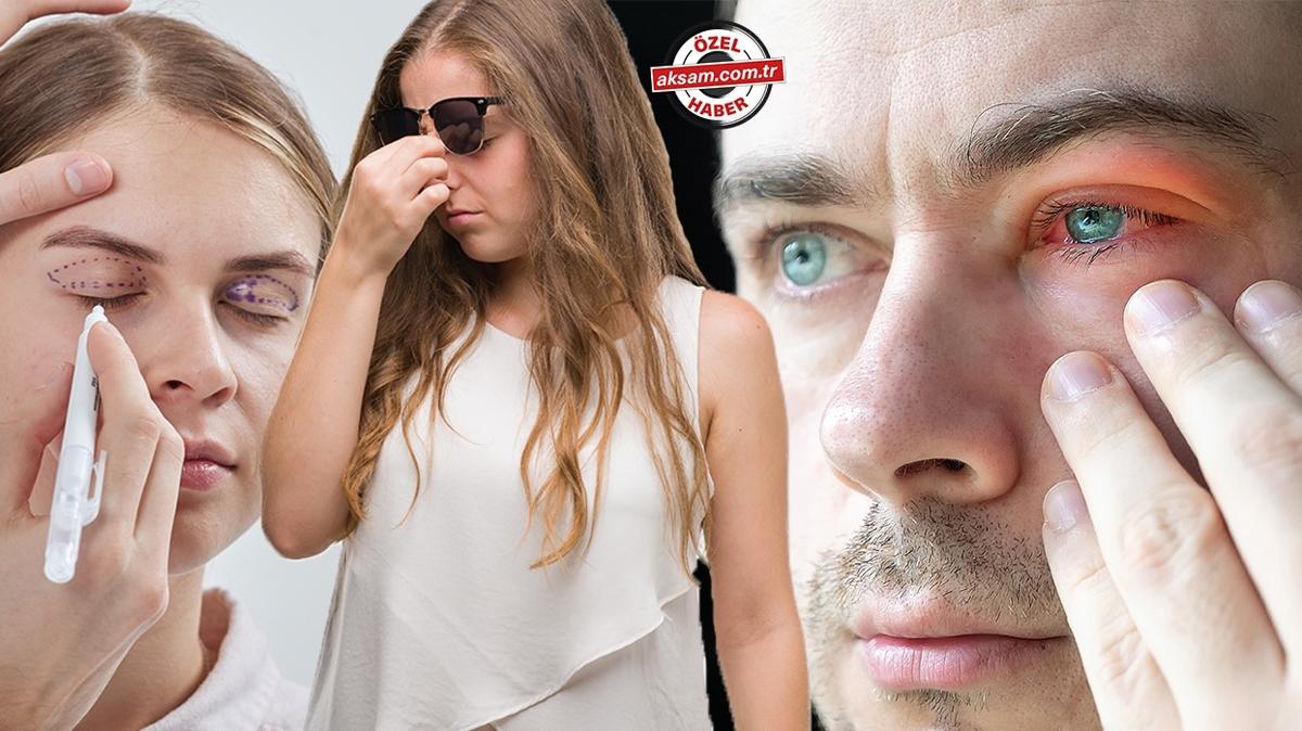 Uzmanndan gne uyars: Sahte gne gzlklerini kullanmak, kullanmamaktan daha tehlikeli