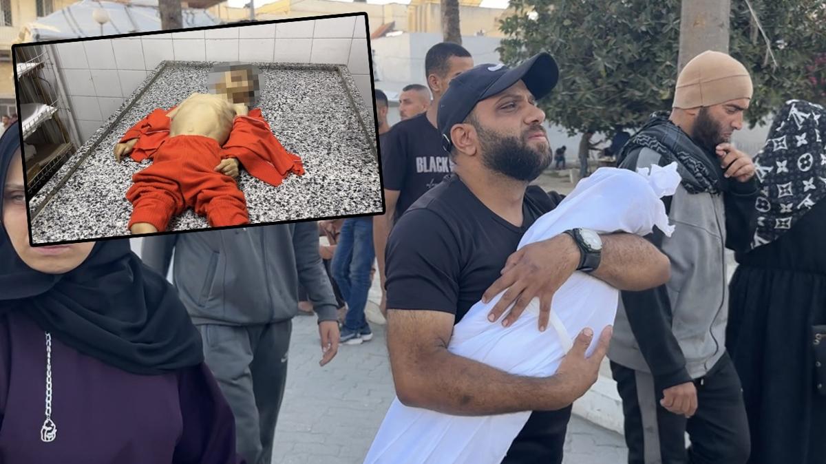 Henz 4 yandayd! Gazzeli Muhammed alktan can verdi