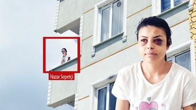 Nazar'n gzne kr kurun! Dn izlerken vuruldu