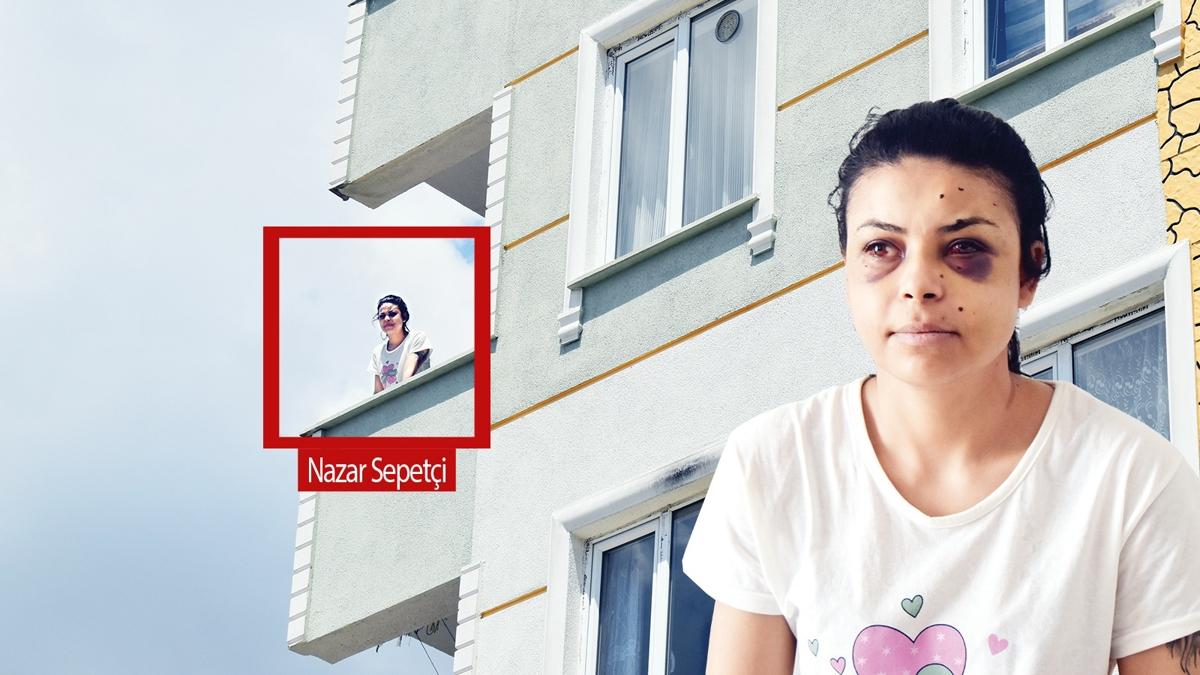 Nazar'n gzne kr kurun! Dn izlerken vuruldu