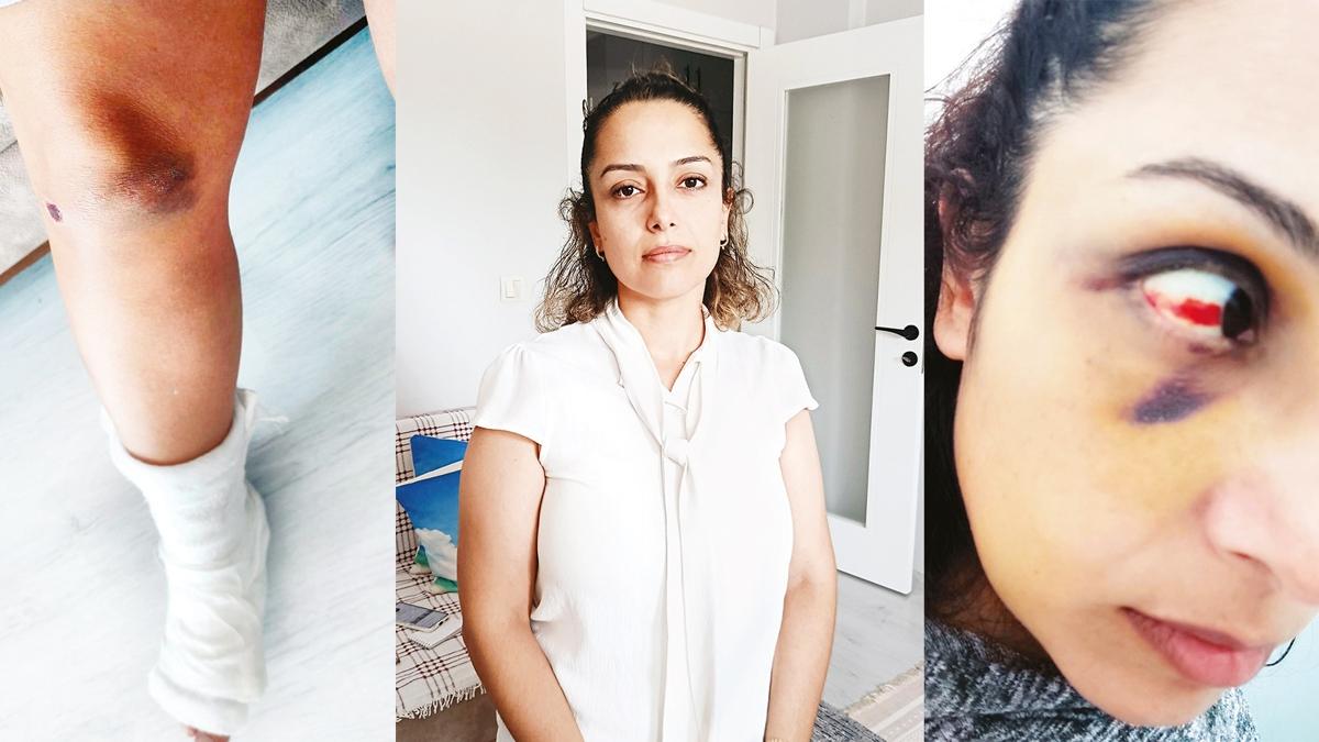 kinci baharda bitmeyen kabus! 1.5 yldr boanamayan Burcu retmen'in yardm l