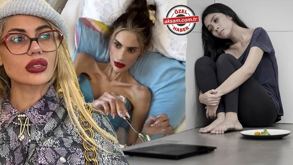 Nihal Candan'a bu tehis konuldu: Yemek ve uykuya dikkat! Anoreksiya Nervoza olabilir