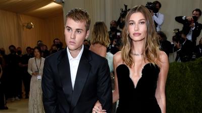 Hailey Bieber 1.5 milyon dolarlk yz parmandan kard! Justin Bieber boanyor mu?
