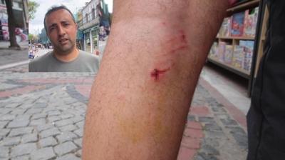 8 sokak kpeinin saldrsna urad