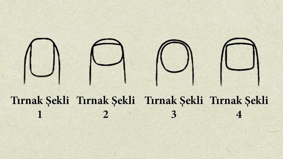 Kiilik testi: Nasl bir lider olursun? Trnan se ve sonucu gr...