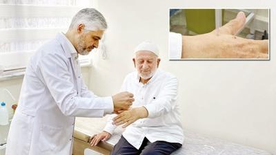 ilk kez Eskiehir'de uyguland! Salk ocanda akupunktur dnemi