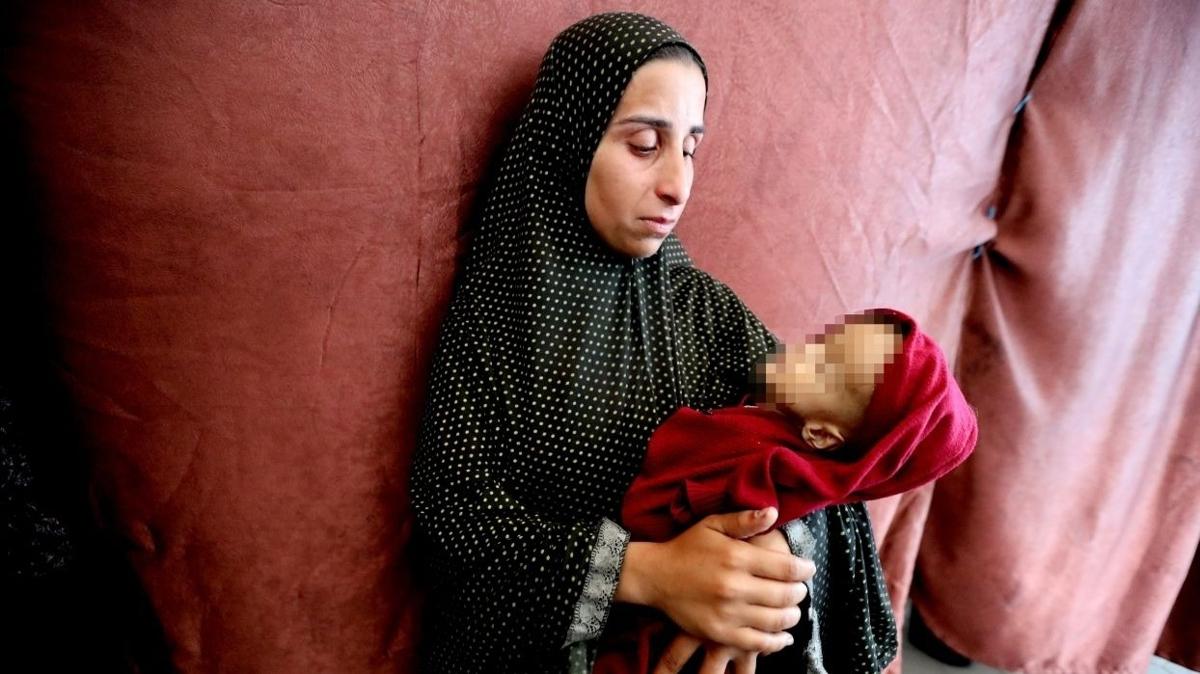 Gazze'de ac tablo: 5 ya alt 650 bin ocuk alkla kar karya