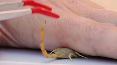 Kendisini zehirli akrebe sokturdu! Yaananlar saniye saniye kaydetti