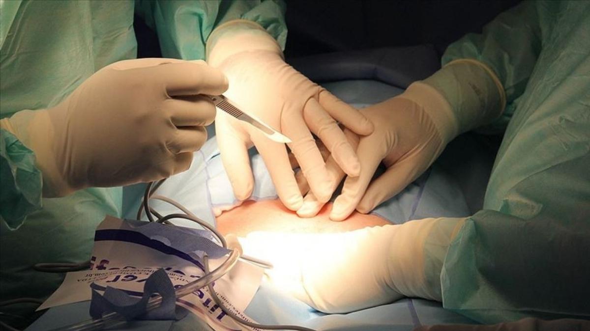 organ ba  e-Devlet  organ nakli fotoraflar resimleri