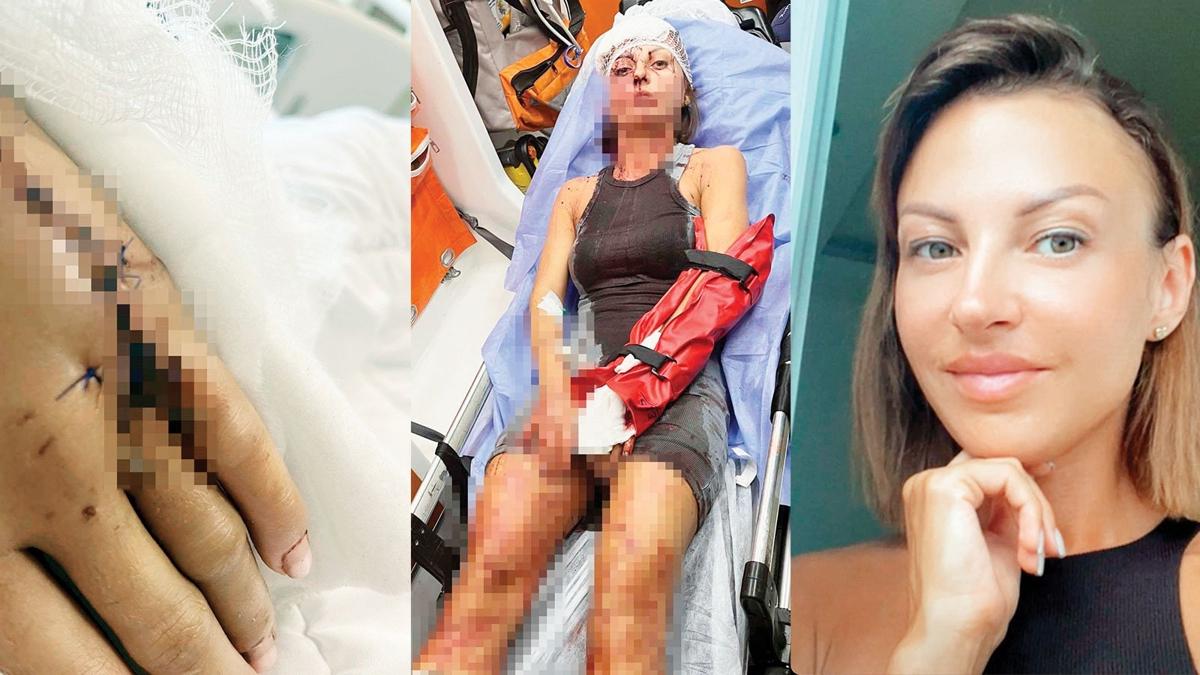 Iryna Melnychuk D Antalya saldr Ukrayna kadn tutuklama uzaklatrma karar fotoraflar resimleri