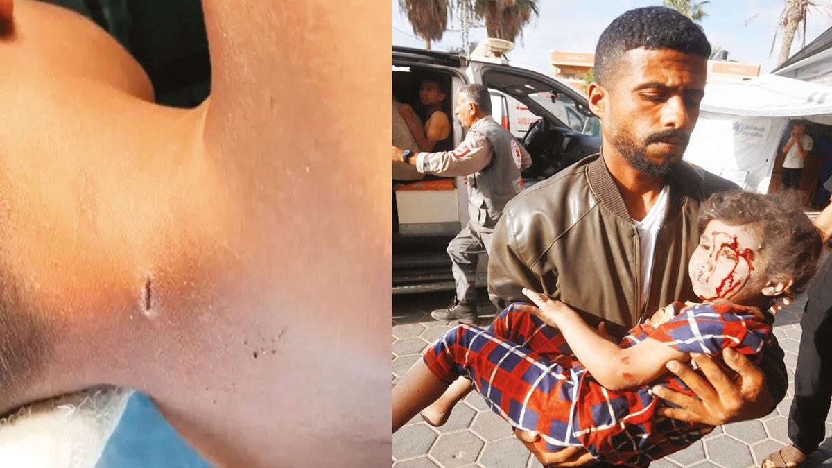 soykrm ocuk lmleri Gazze fotoraflar resimleri