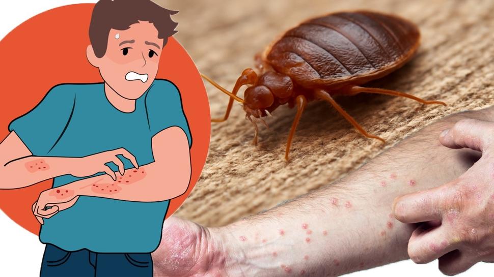 Kanla besleniyorlar! Her yerde bu böcekler var! İlk belirti: Kaşıntı ve ciltte kızarıklık