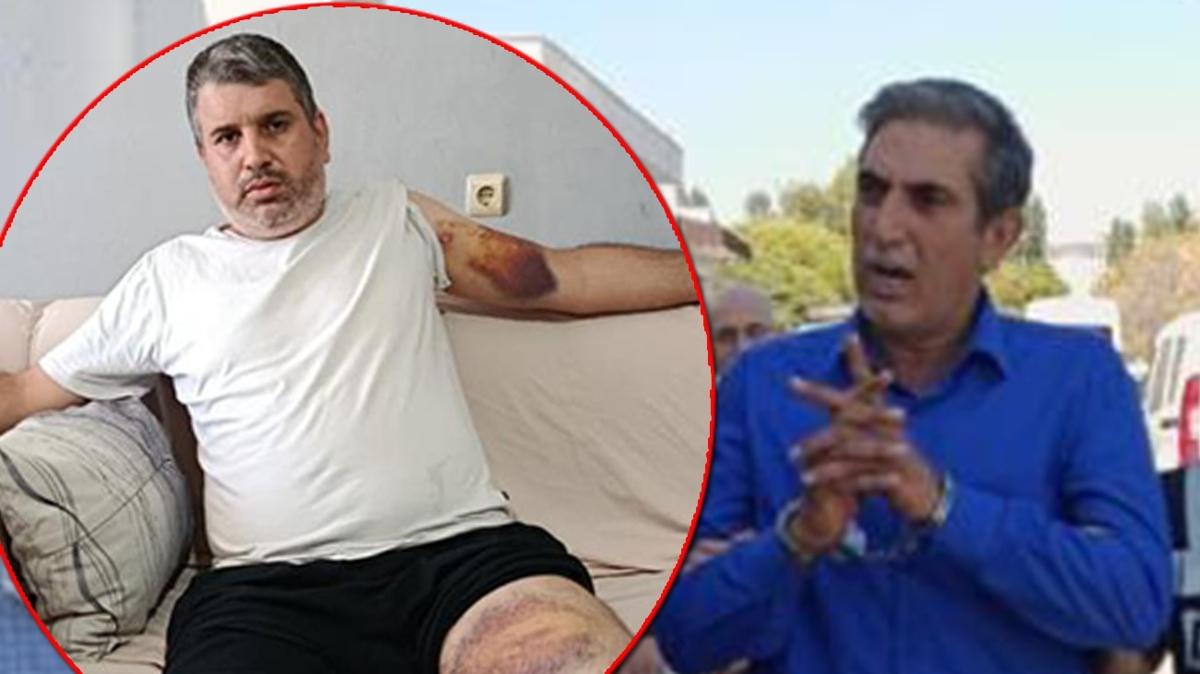 adana miras kavga fotoraflar resimleri