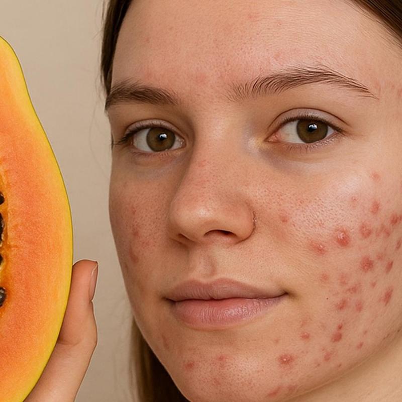 Sivilceleri 1 haftada yok eden meyve: Hem antioksidan hem vitamin