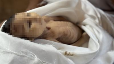 srail zulm hayattan kopard! Gazze'de 5 aylk bebek ehit oldu