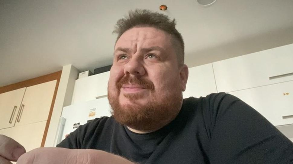 Komedyen Emre Mutlu'nun son hali şoke etti! Tam 133 kilo verdi...