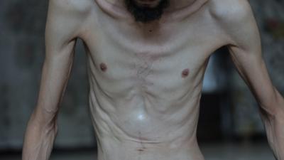 Katilden aklk dayatmas! 10 Filistinli daha ehit oldu