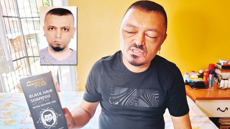 ampuan kbusu! Sa siyahlamad, gz kapand