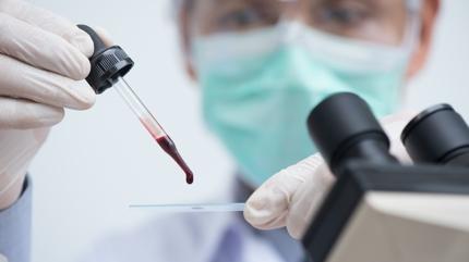 Demir gibi salam kan grubu belli oldu! Mide kanseri bunlara uramyor