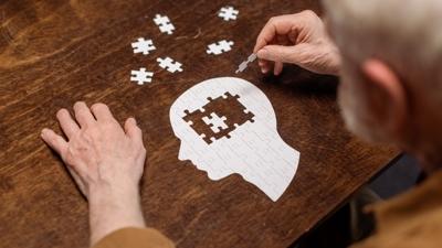 Alzheimer tedavisinde umutlar arttracak admlar!