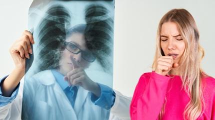 Akcier kanserinin fark edilmeyen 5 belirtisi: ksrk, ar