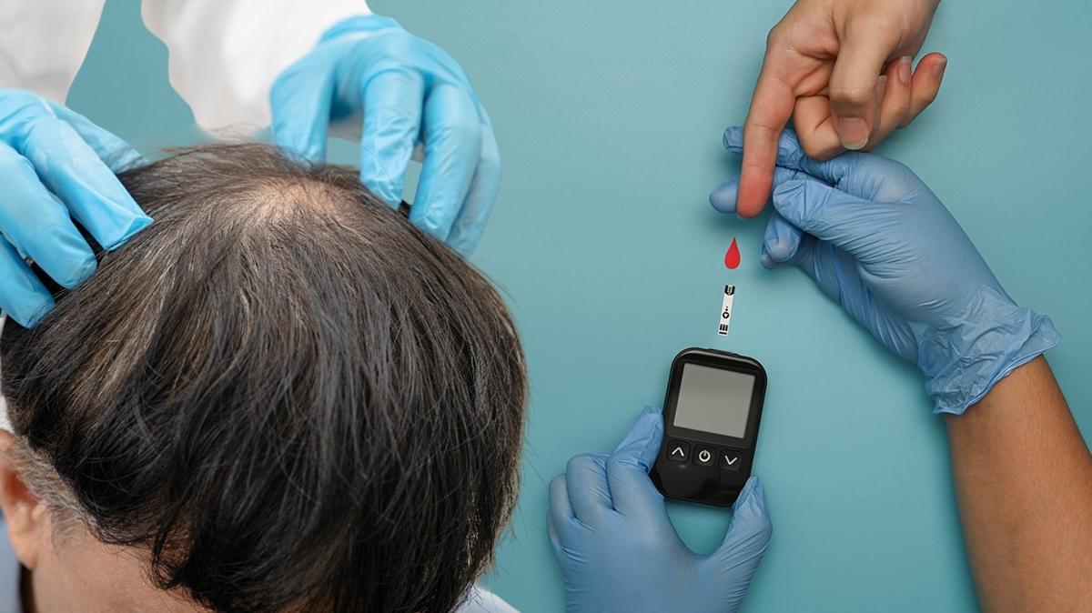 blgesel kellik diyabet salk sorunlar fotoraflar resimleri