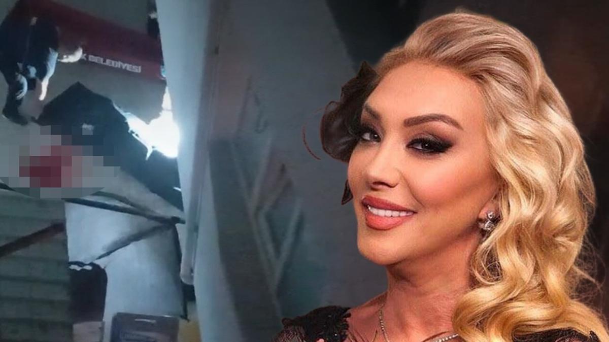 gll adli tp rapor fotoraflar resimleri