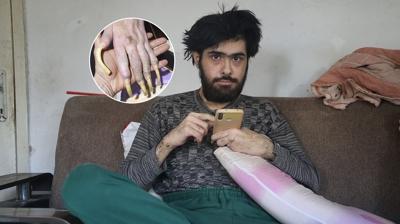 Sanal dnyann esiri oldu! 3 yldr evden kmyor, banyo yapmyor
