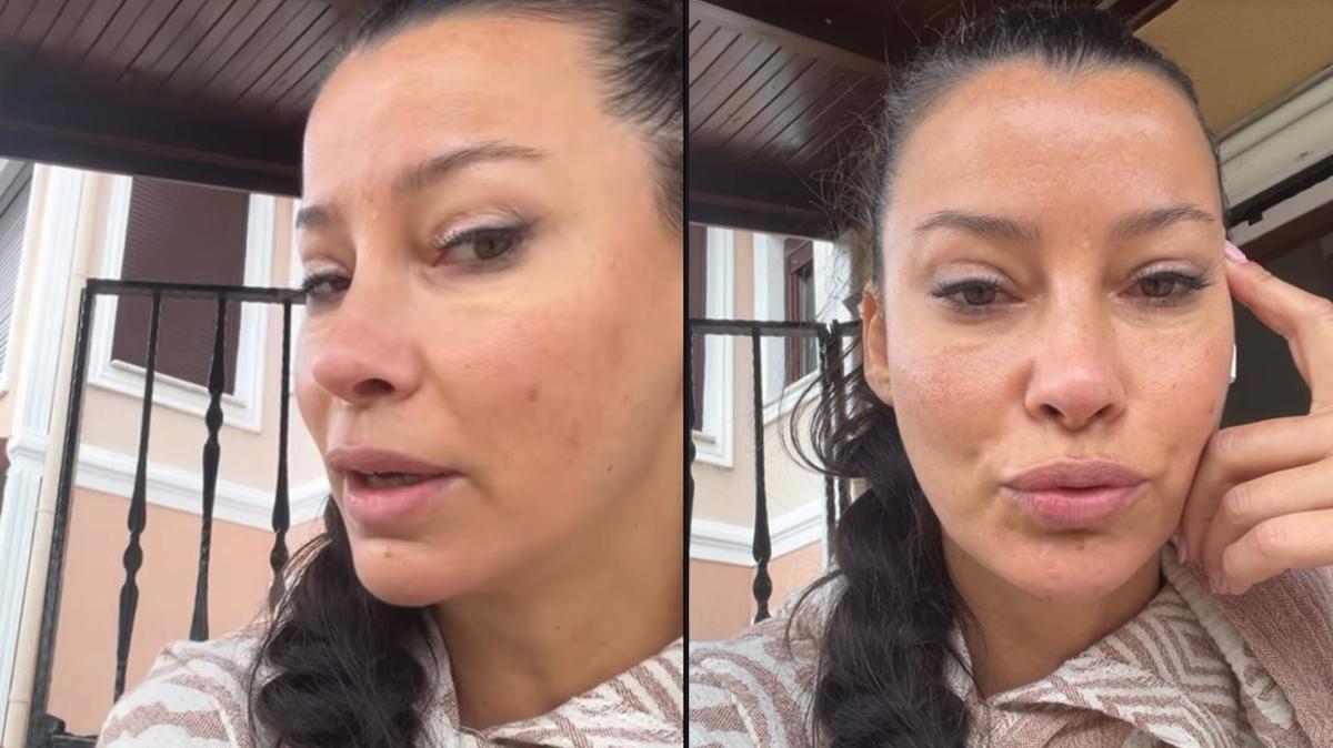 mjde uzman estetik magazin haberleri fotoraflar resimleri