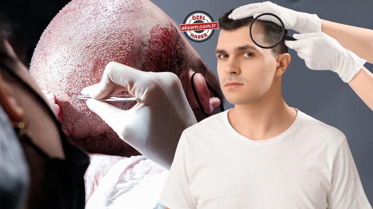 sa ekimi operasyonu sa ekimi sonras ekilen salar sa ekimi fotoraflar resimleri