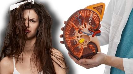 Karacier ve bbrek hastalklar salarda kendini ele veriyor! Salarnz hzl yalanyorsa