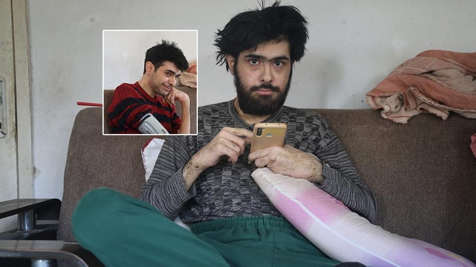 Doktorlar Bar'a tehis koydu: Tedavisi balad